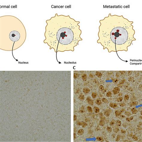 pnc protein|The Perinucleolar Compartment .